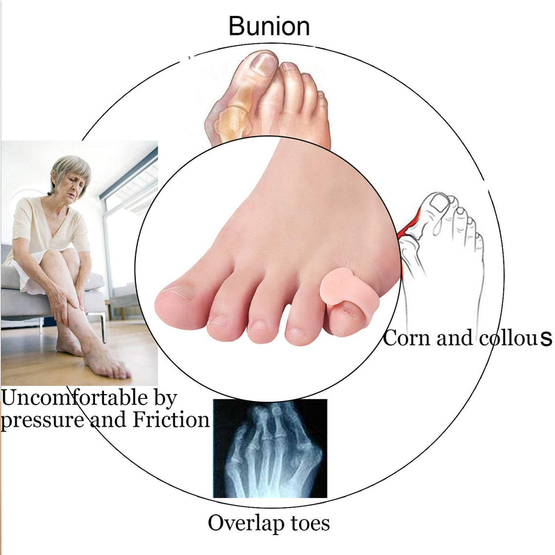 [Australia] - 10 Pcs Pinky Toe Splint, Gel Toe Separators, Little Toe Straightener Hammer Toe for Men Women Walking, Running, Overlapping, Bunion Corrector and Bunion Relief 