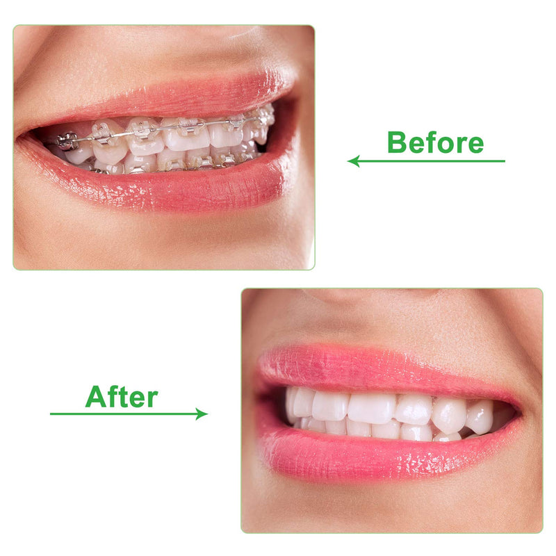 [Australia] - 20 Pieces Aligner Tray Seaters Chewies for Aligner Trays Chompers Aligner Trays (Green) Green 