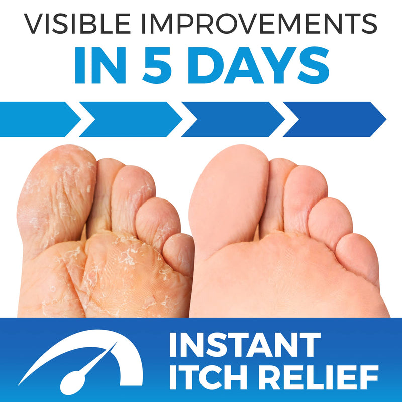 [Australia] - XL Athletes Foot Treatment Cream Extra Strength | Foot Fungus Cream and Toenail Fungus Treatment | Foot Cream Antifungal | Ringworm Foot Care | XL 75 ML 