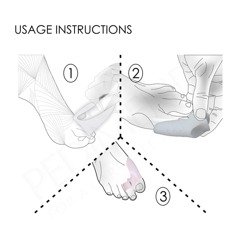 [Australia] - Pedimend Metatarsal Pads for Metatarsalgia Morton's Neuroma & Pedimend Gel Bunion Spacer | Hallux Valgus Deformity Correction Splint | Silicone Big Toe Separator 