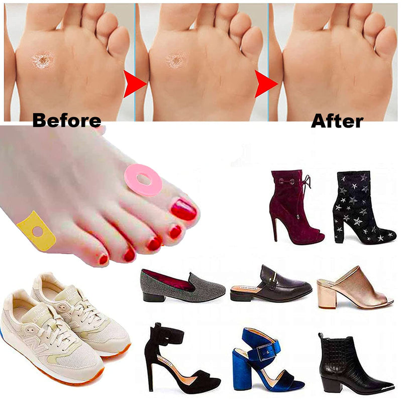 [Australia] - Reppkyh 96 Pieces Self Adhesive Foam Callus Cushions Toe Pads,Corn Pads Rubbing on Shoes, Reduce Foot and Heel Pain Pinky+ Nude 