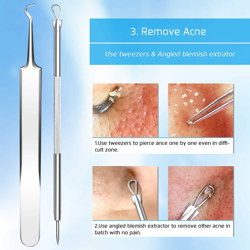 [Australia] - Premium Blackhead Remover, Comedone Blemish Acne Extractor,Popping Pimple Popper Whitehead Removal, Precision Tweezers, Zit Removing, Milia Remove 