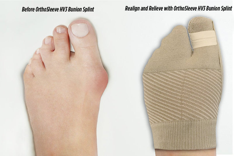 [Australia] - OrthoSleeve HV3 Bunion Brace/Splint (One Sleeve) for Foot Bunion Pain/Hallux Valgus Relief and Split-Toe Design to Help straighten Toes (S/M) S/M 