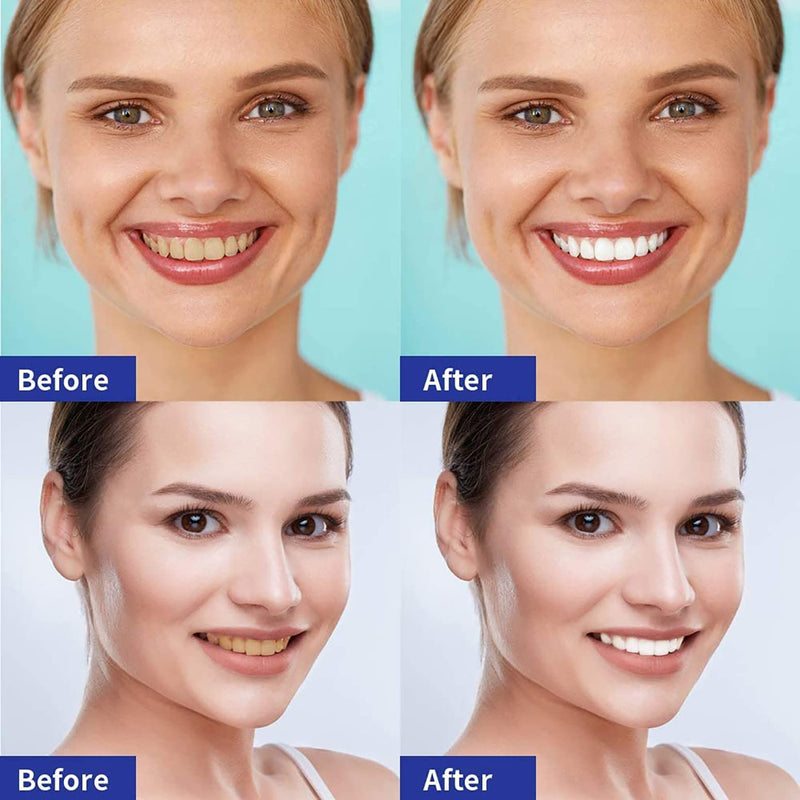 [Australia] - Teeth Whitening Strips, Effective Non-sensitive Teeth Whitening Strips Effective Home Use Tooth Whitening Kit Teeth Whitener Mint Flavor 14 Pouches 28 Strips 