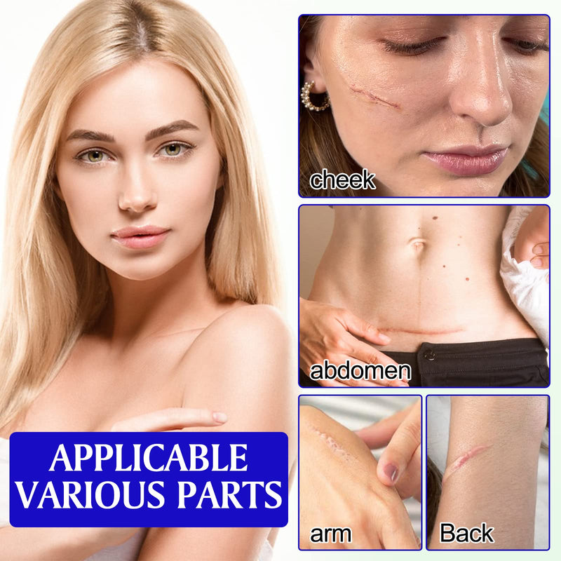 [Australia] - Silicone Scar Sheets, Professional for Scars Caused by C-Section, Surgery, Burn, Keloid, Acne, and More(7.6CMX4CM, 20PCS) 7.6CMX4CM, 20PCS 