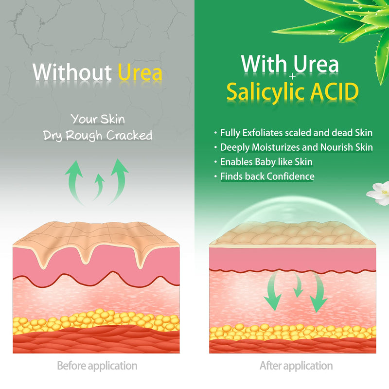 [Australia] - Urea Cream 42% Foot Cream Salicylic Acid 4.3 Oz, Upgraded Callus Remover For Feet, Knees& Elbows, Intensive Moisturizes & Softens Skin, Exfoliates Dead Skin By Vebuni 