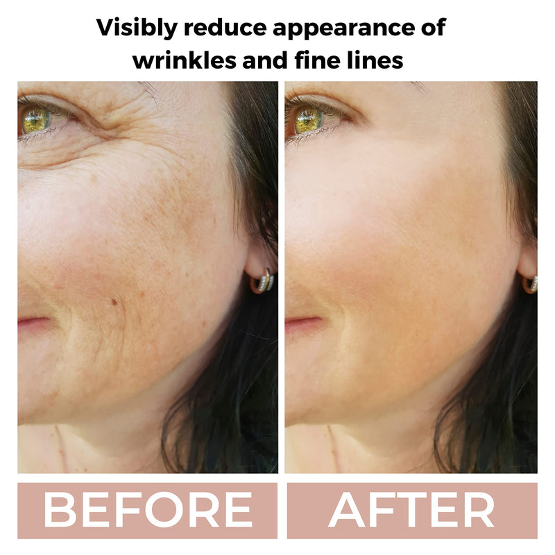 [Australia] - Ammuri Retinol High Strength Serum (3.5% Retinol) Anti Aging Formula 3.5% Retinol 