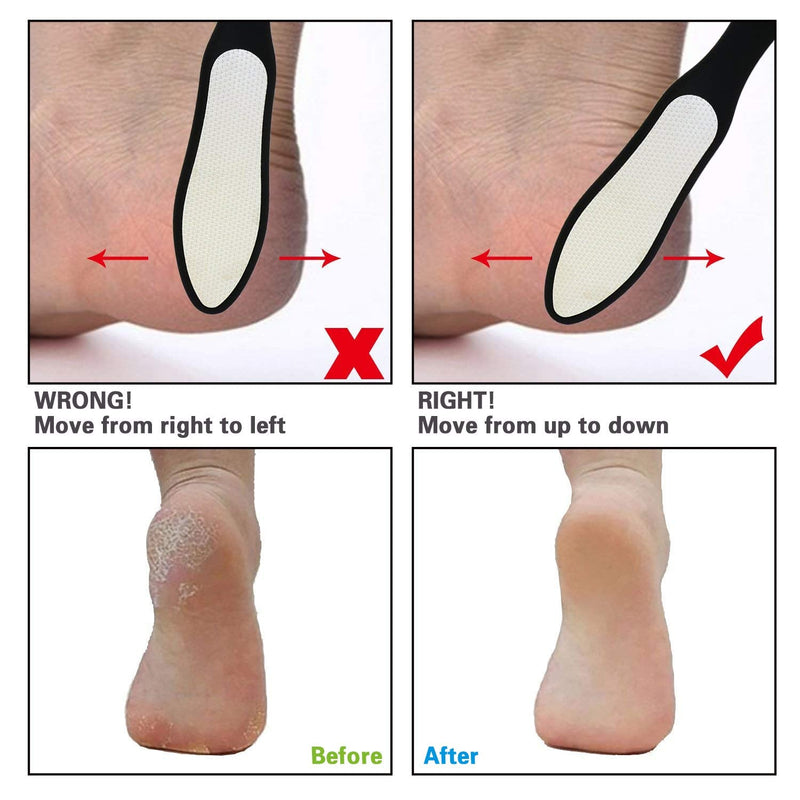 [Australia] - Foot File, Callus Remover Surgical Steel Dual-Sided Foot Rasp Pedicure for Feet Care Hard Skin Remove 