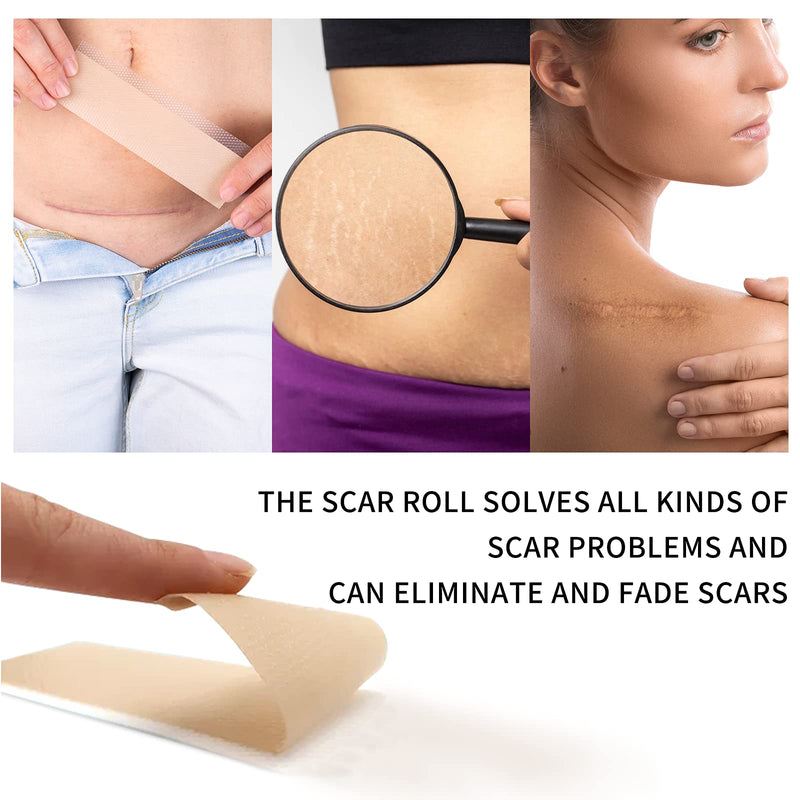 [Australia] - Silicone Scar Sheets (4x300CM), Professional Removal New & Old Scars from Post Surgery,Injury,Burns, Acne Scar Treatment, C-Section, Keloid 