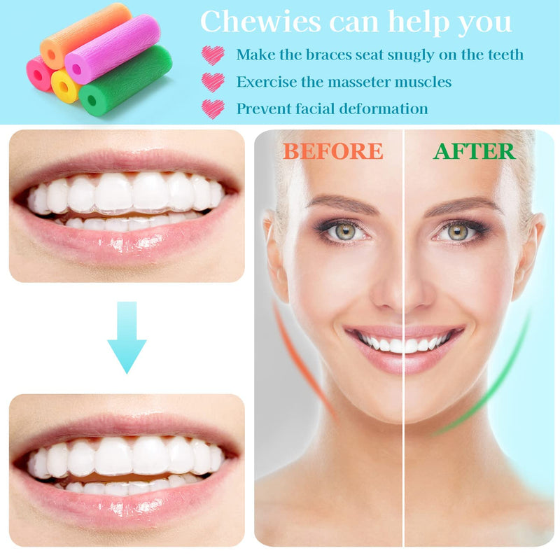 [Australia] - 10 Pcs Aligner Chewies Dental Teeth Chewies Resuable Tray Seaters for Orthodontic Trays Chewy Dental Plaque Removal Tool (Green) Green 