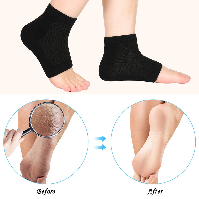 [Australia] - Bememo 3 Pairs Soft Ventilate Gel Heel Socks Open Toe Socks for Dry Hard Cracked Skin Moisturizing Day Night Care Skin (Black, Regular Size) 