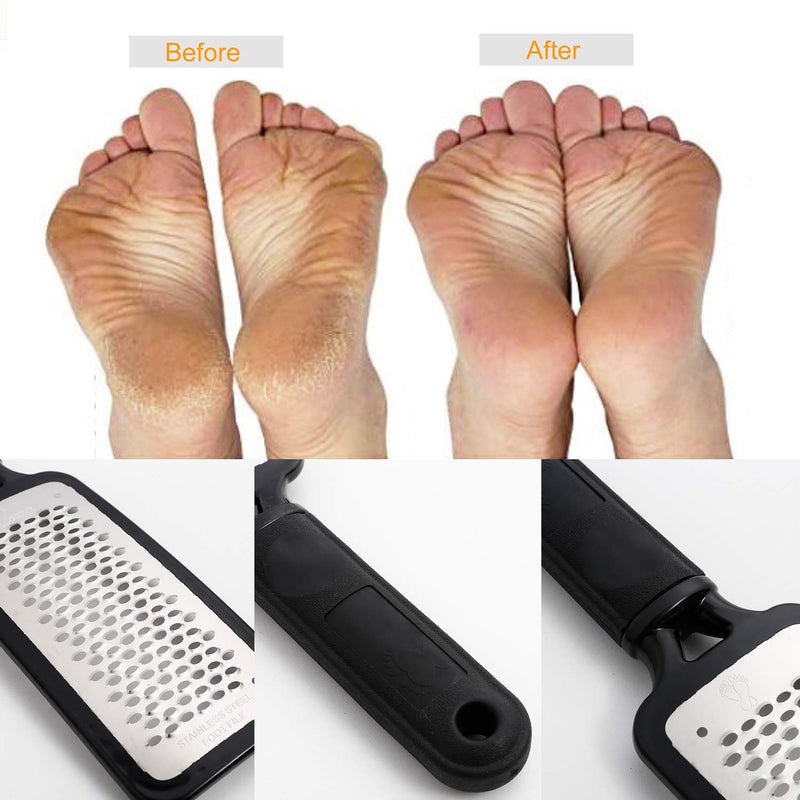 [Australia] - Foot File Callus Remover,Colossal Foot Rasp and Professional Foot Scrubber Pedicure Kit to Remove Hard Skin for Wet and Dry Feet,Surgical Grade Stainless Steel File (black and silvery) black and silvery 