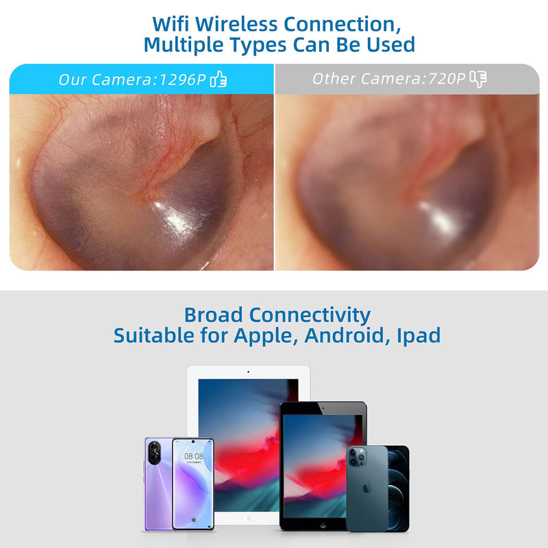 [Australia] - VITCOCO Ear Wax Removal, Wireless Ear Cleaner with 1296P HD Ear Camera and 3.9mm Ear Otoscope, Earwax Removal Tool with 6 LED Lights, Kids Adults Ear Cleaning Endoscope for iPhone Android Phones Black 