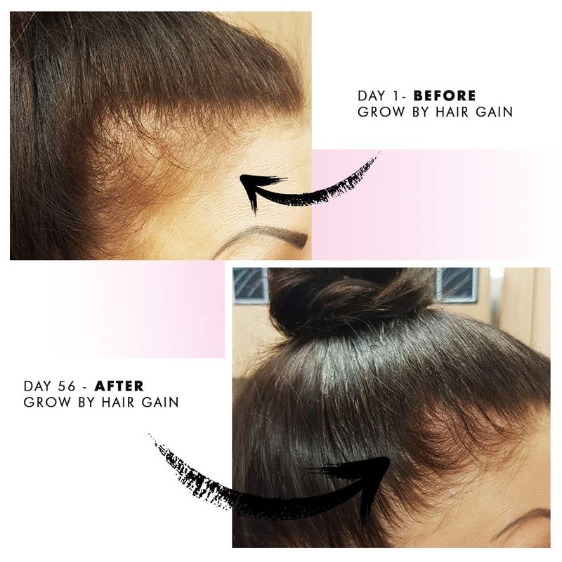 [Australia] - Grow by Hair Gain 1 Month supply 60 Capsules Fuller Thicker Hair in one month 