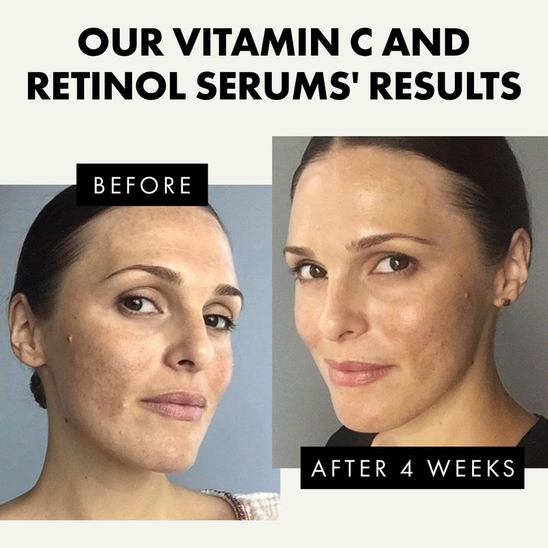 [Australia] - Retinol and Vitamin C Serum, Face Serum with Hyaluronic Acid, Aloe Vera, and Jojoba Oil, Helps to Reduce Fine Lines, Wrinkles and Acne Scar, 30 ml X 2 