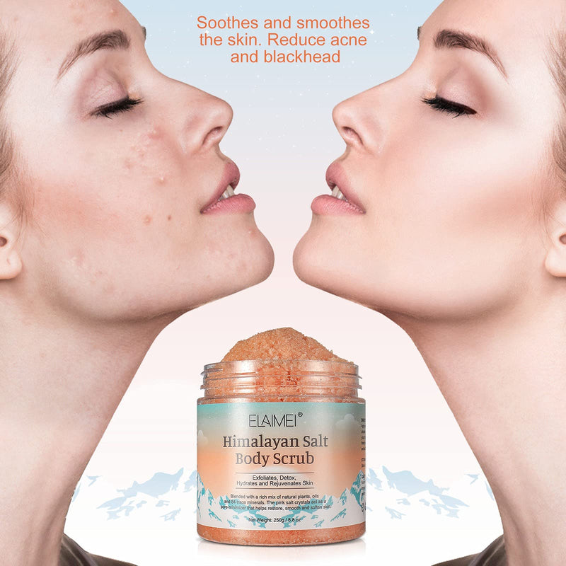 [Australia] - Himalayan Salt Body Scrub Infused with Lychee Oil, Natural Exfoliating Salt Scrub for Acne, Cellulite, Deep Cleansing, Scars, Wrinkles, Exfoliate and Moisturize Skin 8.8 oz 