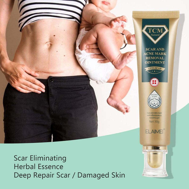 [Australia] - 2 Pack TCM Scar Removal Gel and Acne Mark Removal Cream Ointment, Acne Scar Removal Cream Skin Repair Acne Spots Remover Blackhead Stretch Marks 