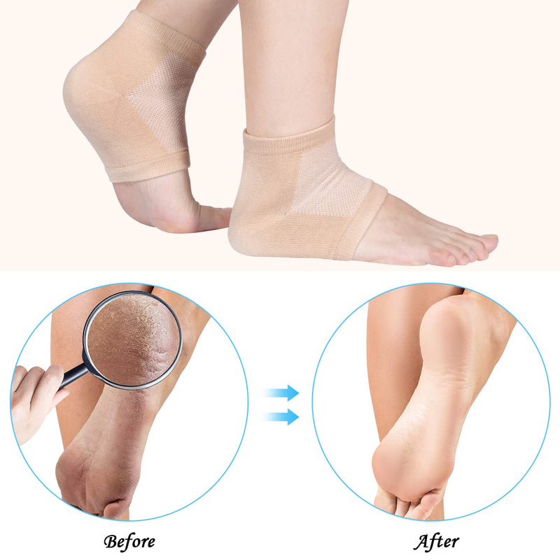 [Australia] - Bememo Soft Gel Heel Socks Ventilate Open Toe Socks 4 Pairs for Dry Hard Cracked Skin Moisturizing Day Night Care Skin (Beige) 