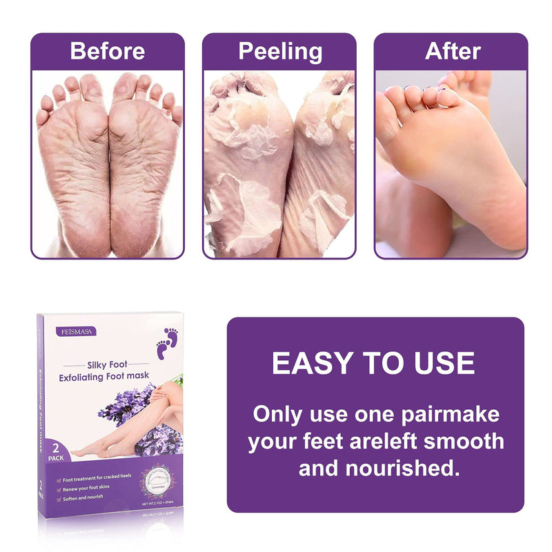 [Australia] - Foot Peel Mask-2 Pairs Exfoliating Foot Mask For Foot Callus Remover,Soft Touch For Dry Cracked Feet,Dry Feet Treatment At Home Pedicure, Lavender Scented 