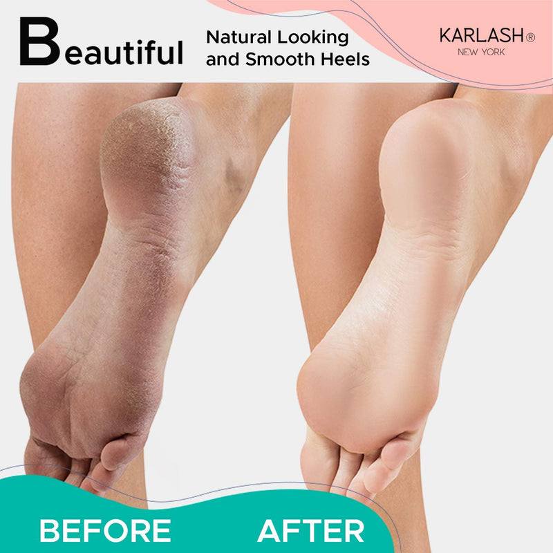 [Australia] - Karlash 2-Sided Mint Nickel Foot File + Pumice Stone for Feet Skin Callus Remover and Scrubber for Dead Skins 