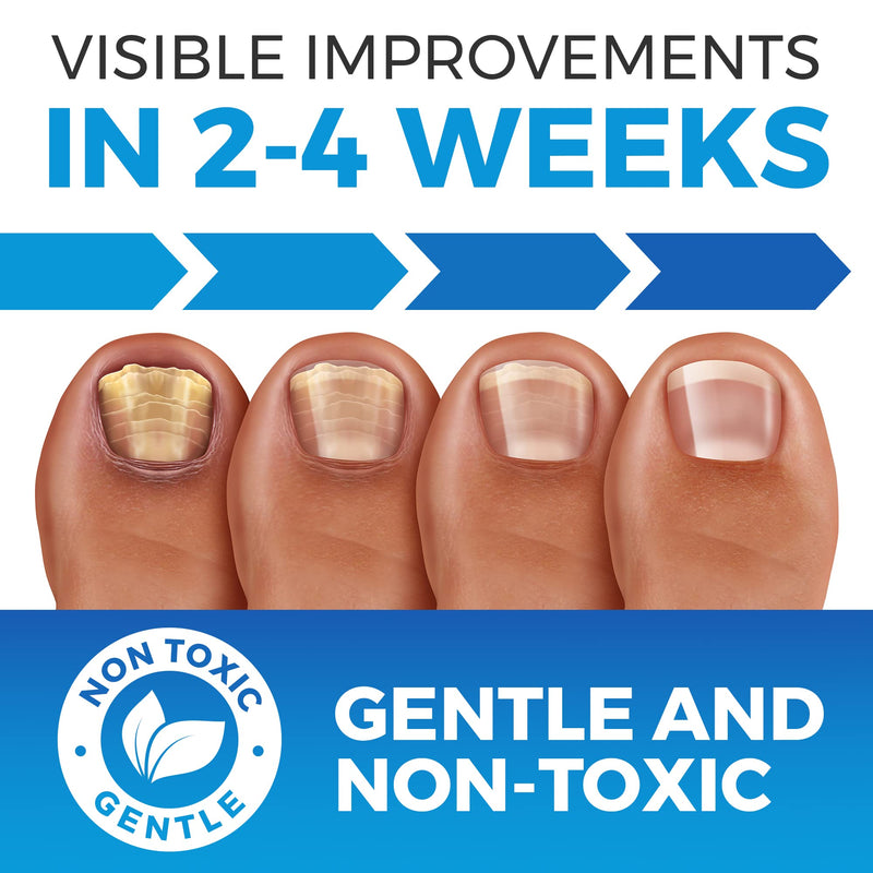[Australia] - Anti Fungal Nail Treatment | Severe Fungal Nail Treatment for Toenails Extra Strong | Extra Large 75ML 