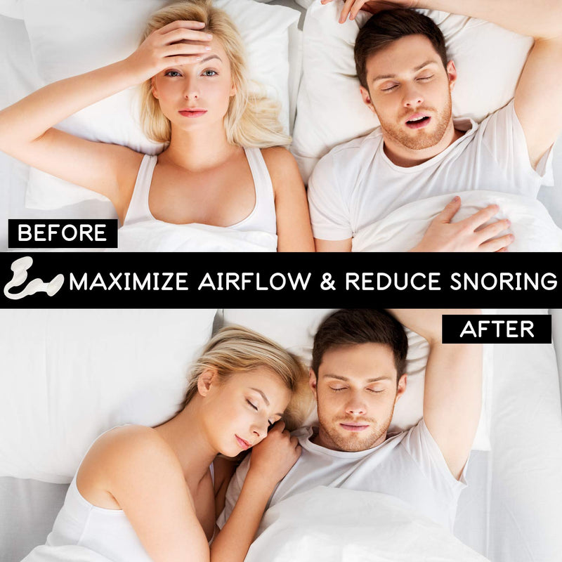 [Australia] - AIRMAX Nasal Dilator for Better Sleep - Natural, Comfortable, Anti Snoring Device, Snoring Solution for Maximum Airflow and Easier Breathing (Medium - Clear) 