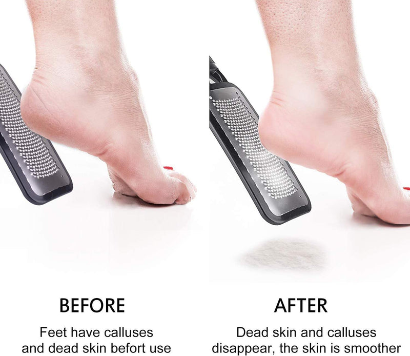 [Australia] - FOLAI Foot File Foot Pedicure Tool, Stainless Steel Foot File, Dead Skin Remover Foot Care Pedicure Tool for Cracked Feet, Make Foot Beauty and Extra Smooth(Black) Black 
