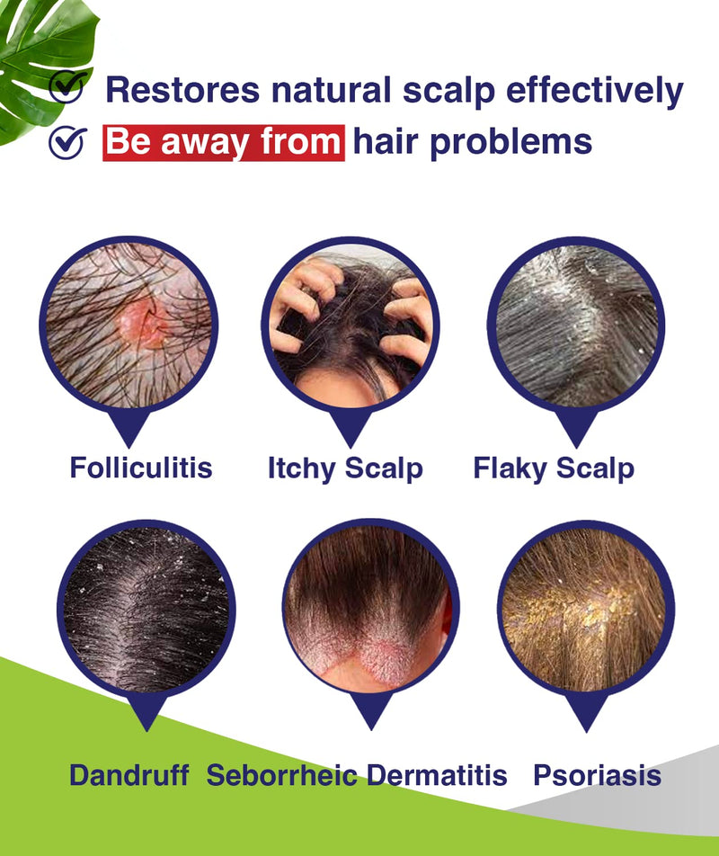 [Australia] - Folliculitis Shampoo, Seborrheic Dermatitis Shampoo, Anti Dandruff Shampoo, Antifungal Shampoo, Folliculitis Treatment, Dandruff Treatment, Scalp Psoriasis Treatment, Relieve From Itchy & Dry Scalp Folliculitis Shampoo 