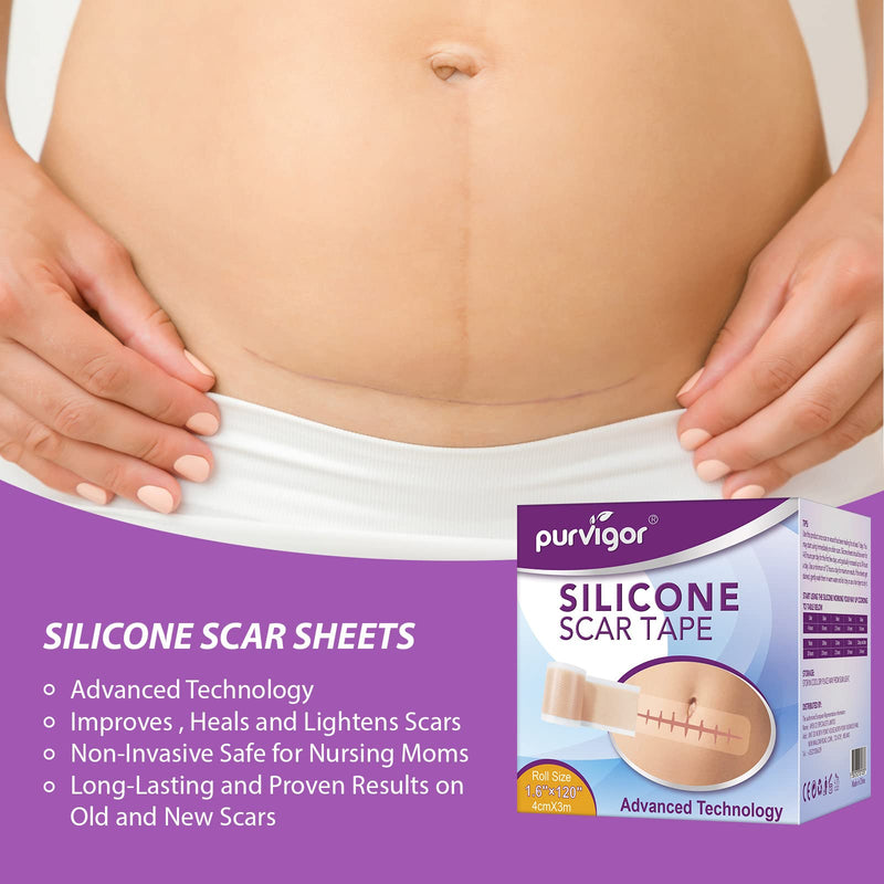 [Australia] - Silicone Scar Sheets(1.6" x 120"), Scar Tape for Scars Removal Treatment, Reusable Professional Scar Removal Strips for New and Old Scars 