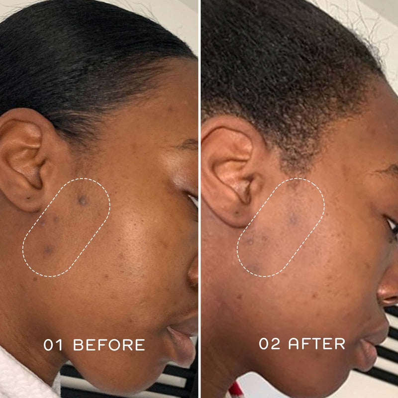 [Australia] - REN Clean Skincare Dark Spot Removal Overnight Cream - Proven to Reduce Hyperpigmentation with Natural Algae and Phytoglycogen - Cruelty Free & Vegan Hydrating Facial Moisturizer, 50 ml 