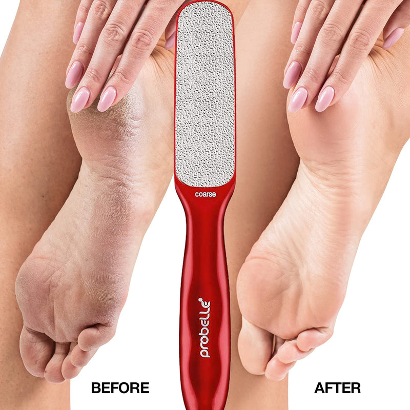 [Australia] - Probelle Double Sided Multidirectional Nickel Foot File Callus Remover - Immediately Reduces calluses and Corns to Powder for Instant Results, Safe Tool (Red) Red 