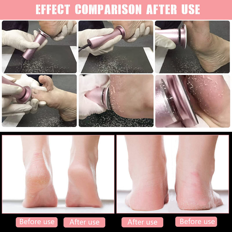 [Australia] - HANNAH.QI Electric foot file callus remover professional safe adjustable speed 60pcs replaceable sandpaper disc easy to remove cutin dead skin calluses available for men and women(black 60pcs) black 60pcs 