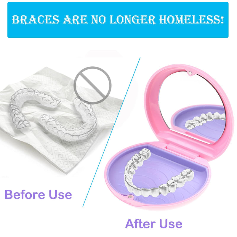 [Australia] - Retainer case, Retainer Case with Mirror, Orthodontic Denture Box with Magnetic Seal Textured Liner, Multifunctional Mouth Guard Denture Case for Retainers, Mouthguards, Braces (Pink) 