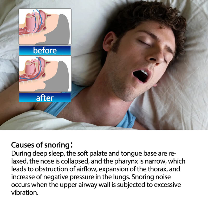 [Australia] - Anti Snore Devieces,Anti Snoring Stickers,Nose Breathing Anti Snoring Less Mouth Breathing Instant Snoring Relief Anti Snore Stopper Improved Nighttime Sleeping 