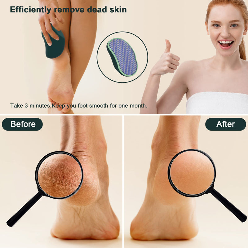 [Australia] - SIRALMNO Upgrade 2-in-1 Nano Glass Callus Remover,Foot Scraper which Used Wet and Dry Callus Removal,Foot Rasp for Hard&Dead Skin Foot Care,Safe & Portable Foot File 
