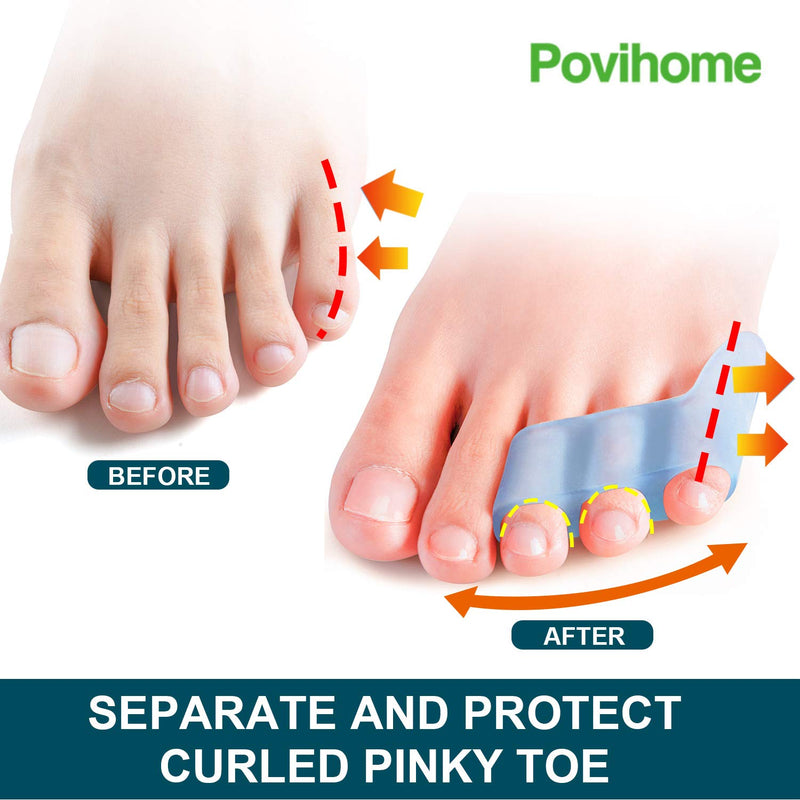 [Australia] - Povihome 10 Pack Pinky Toe Separator and Protectors, Toe Separators for Overlapping Toe, Curled Pinky Toes Separate and Protect - Spacers for Morton's Neuroma Pain Relief 