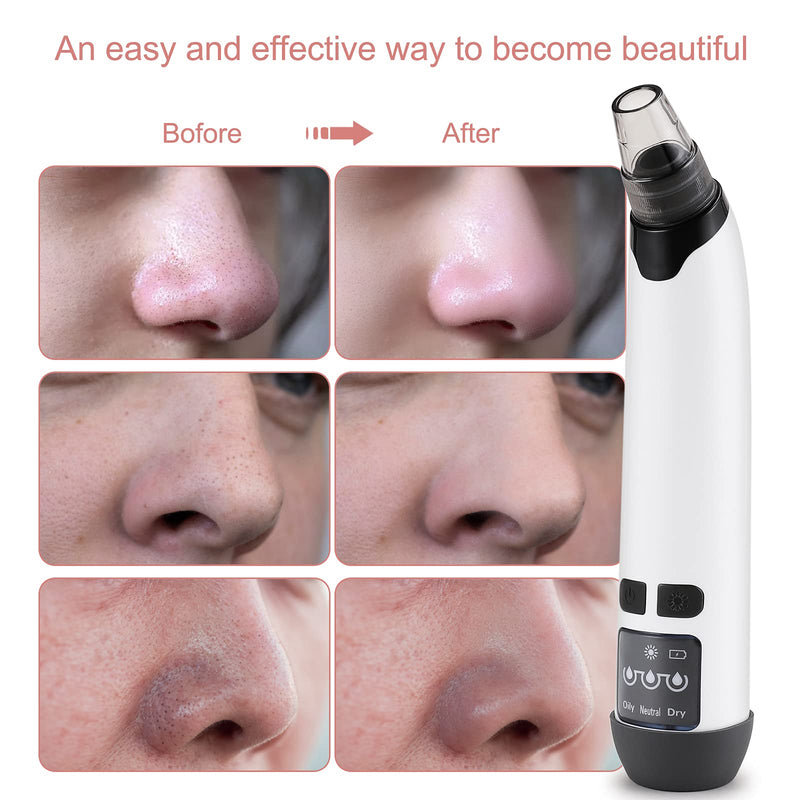 [Australia] - Boobeen Blackhead Remover - Electric Vacuum Pore with Hot Compress - USB Rechargeable Cleaner Extractor Tool with 3 Modes and 4 Suction Probes WB1 