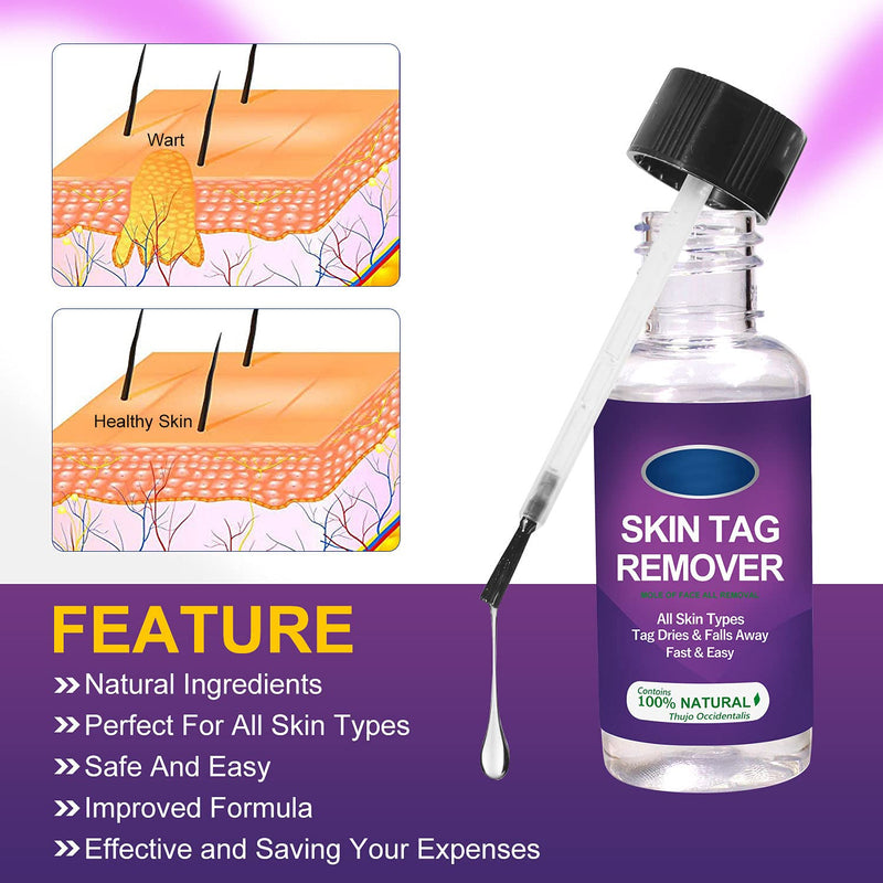 [Australia] - Wart Remover, Skin Tag Remover for Common Warts Treatment, Callus Painlessly, Effective and Safe, Suitable for Face and Body 