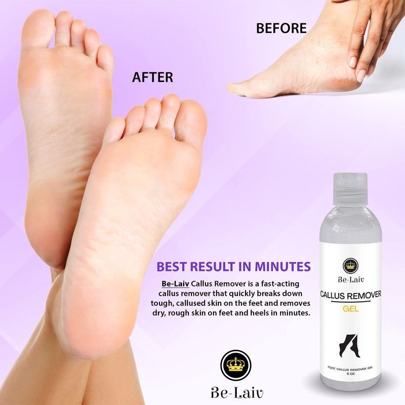 [Australia] - Be-Laiv 8 Oz. Callus Remover Gel | Extra Strength for Feet | Help to Remove Residue & Dead Skin in 3 to 5 Minutes | Pedicure Feet at Home | Professional Strong Corn Eliminator | Foot Scrubber 