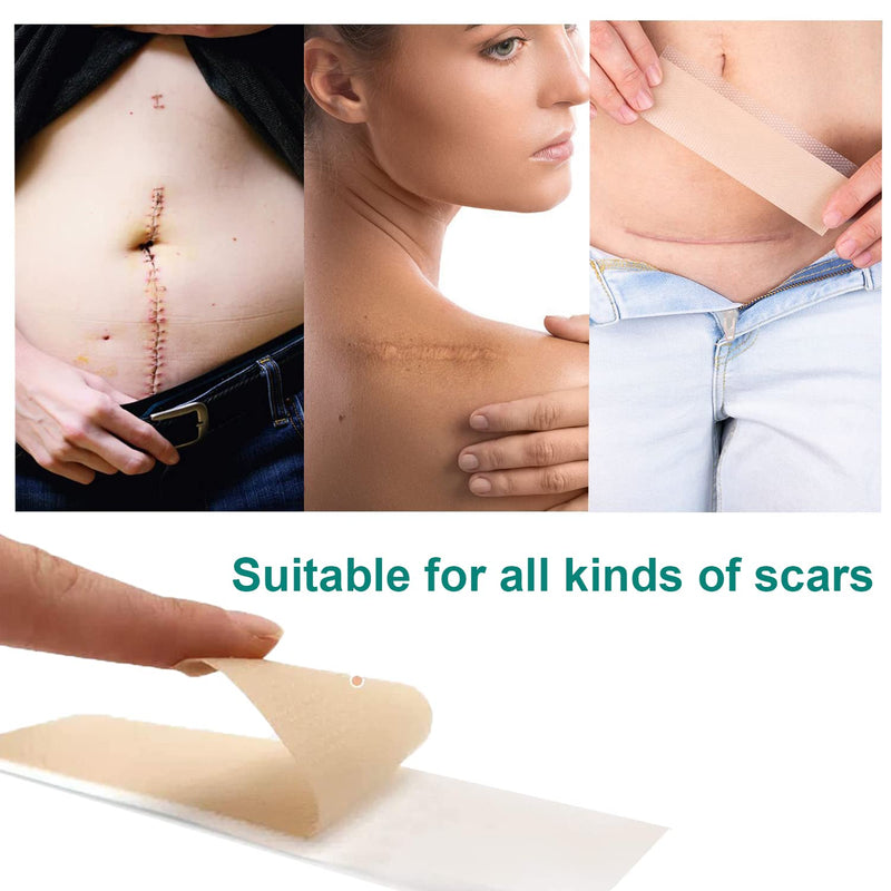 [Australia] - Silicone Scar Sheets, Silicone Sheet for Scar Removal, Gel Scar Repair Treatment Remover for Skin Fast Effective on Keloid Surgery Burn Acne C-Section Stretch Marks 