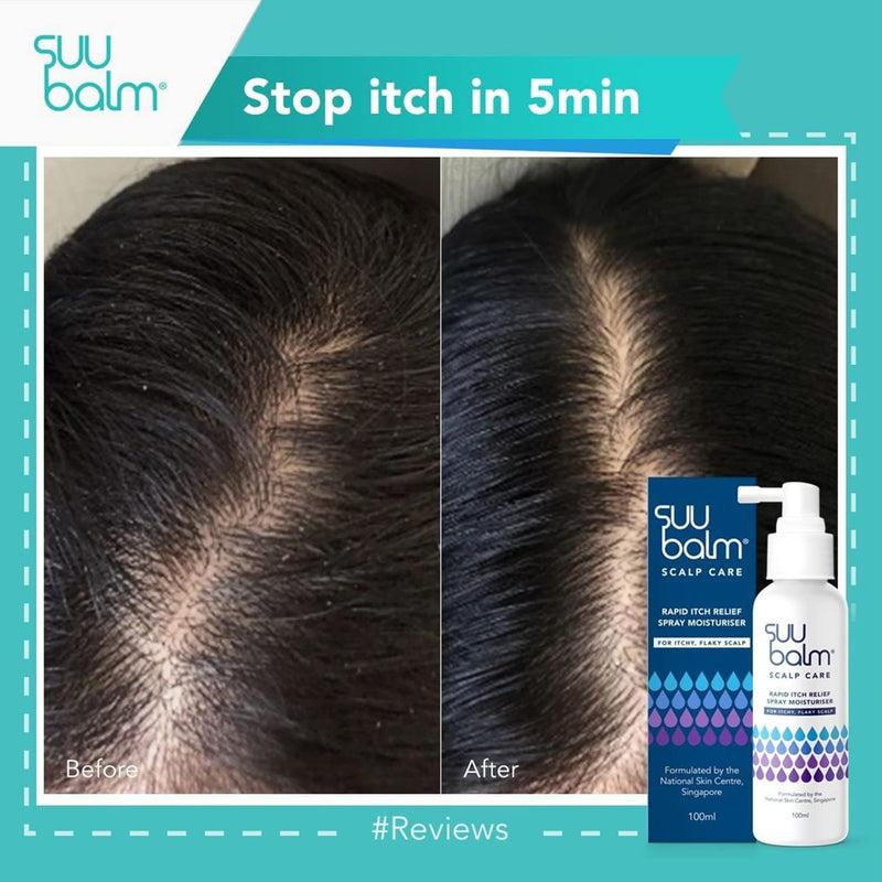 [Australia] - Suu Balm - Scalp Care Rapid Itch Relief Spray Moisturiser - Dry, Itchy, Flaky Scalp Treatment (100ml) 
