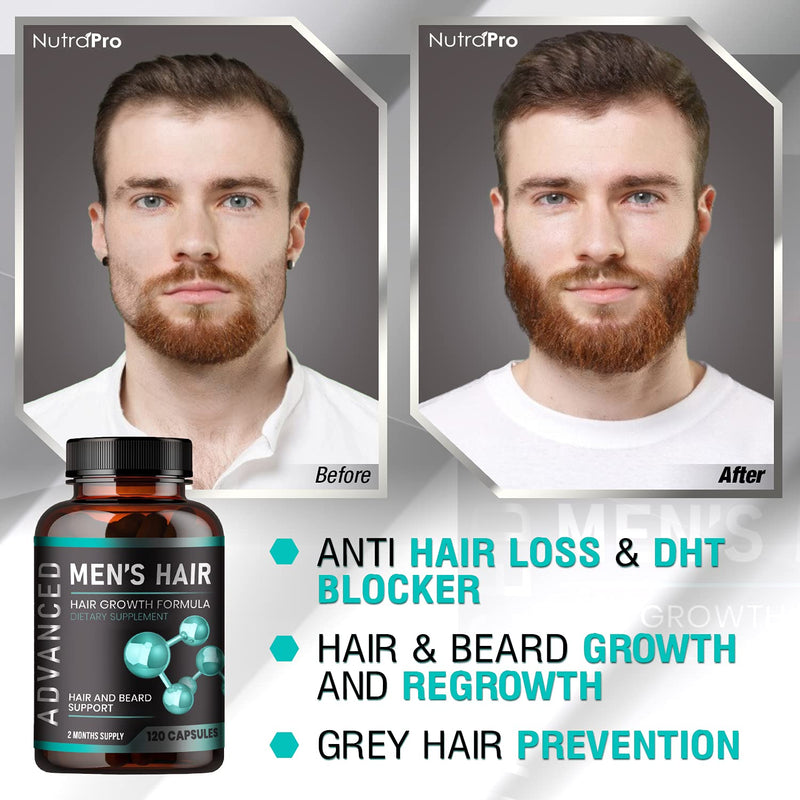 [Australia] - Hair Growth Vitamins For Men - Anti Hair Loss Pills. Regrow Hair & Beard Growth Supplement For Volumize, Thicker Hair.Stop Hair Loss And Thinning Hair With Biotin & Saw Palmetto Hair Vitamins.120 Caps 