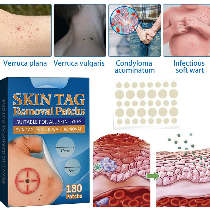 [Australia] - Skin Tag Removal Patches,Mole Removal Patches,Wart Removal Sticker,Spot Removal Stickers,Fast-Acting for Different Size of Warts,180pcs 