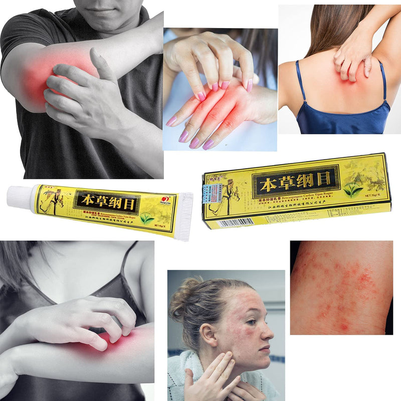 [Australia] - 5Pcs Chinese Herbal Eczema, Psoriasis Creams Dermatitis and Eczema Pruritus Psoriasis CEZUBEM Ointment New 