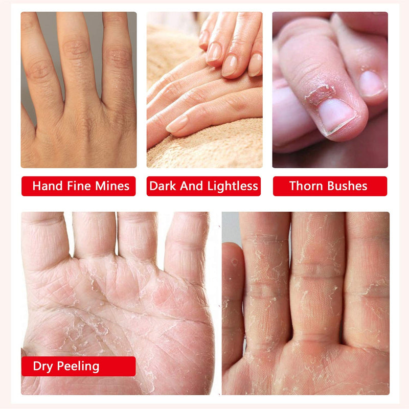 [Australia] - 5 Pairs Hands Moisturizing Gloves, Hand Skin Repair Renew Mask w/Infused Collagen, Moisture Enhancing Gloves for Dry, Aging, Cracked Hands(Honey&Milk) 5 Pair 