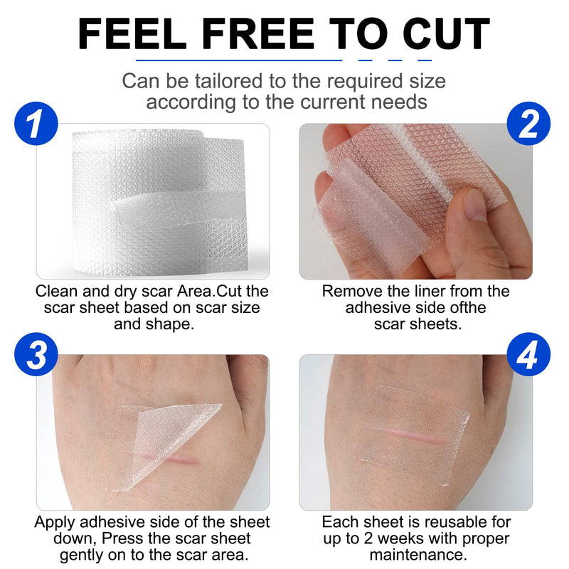 [Australia] - Advanced Silicone Scar Sheets, Transparent Scar Strips, Gel Tape for Scar Removal, Reusable and Effective Removal New and Old Scars(4X300CM) 