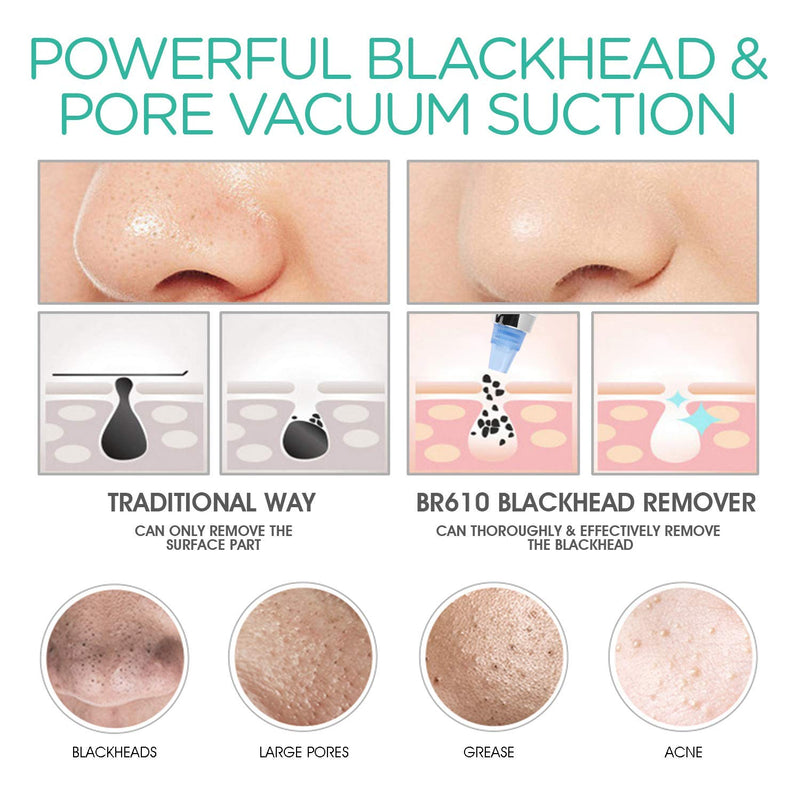 [Australia] - VOYOR Blackhead Remover Pore Vacuum - Electric Face Vacuum Pore Cleaner Acne White Heads Removal with 5 Suction Head, 5 adjustable strength level & LCD Screen BR610 