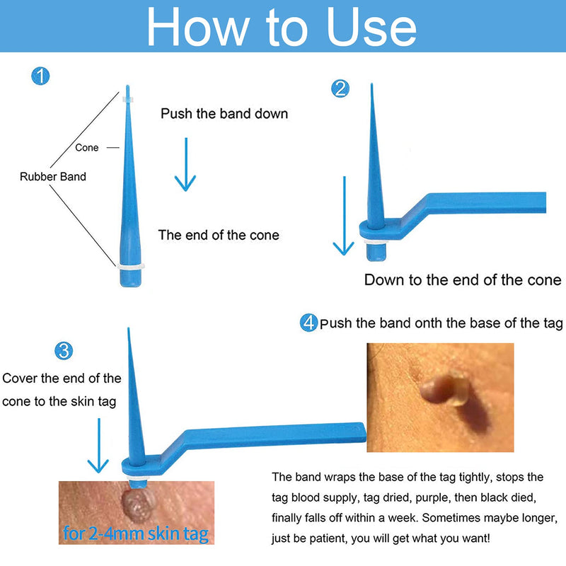 [Australia] - Rpanle Skin Tag Remover, Skin Tag Removal Kit with 20 Skin Tag Bands, Painless and Safe Remove Small to Large Sized (2mm to 4mm) Skin Tag 