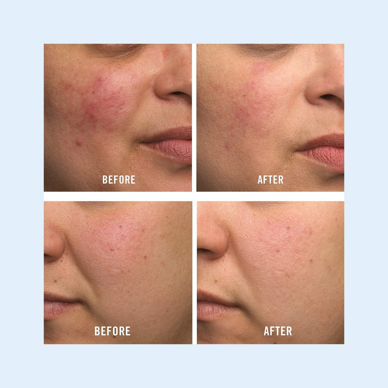 [Australia] - First Aid Beauty Ultra Repair Cream Intense Hydration Moisturiser for Face and Body - 2 oz. Travel Size 56 g 