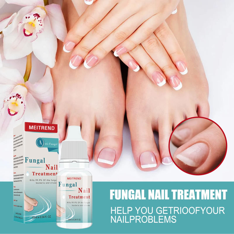 [Australia] - Fungal nail treatment, Nail Fungus Treatment, Anti fungal Nail Solution,Repair and Strengthen Nails— Nail Care Fungus on Toenails & Fingernails 